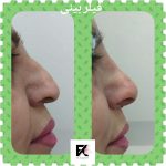 دکتر فرهاد کاوه در کرج