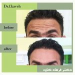 دکتر فرهاد کاوه در کرج