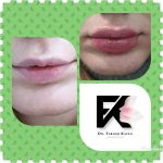 دکتر فرهاد کاوه در کرج