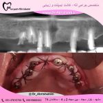 دکتر مریم ابریشمی دندانپزشک در مشهد