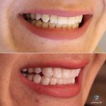 بهترین دندانپزشک زیبایی دکتر مهسا کوکبی در شیراز