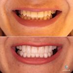 بهترین دندانپزشک زیبایی دکتر مهسا کوکبی در شیراز