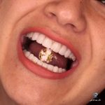 بهترین دندانپزشک زیبایی دکتر مهسا کوکبی در شیراز