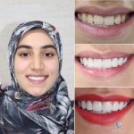 بهترین دندانپزشک زیبایی دکتر مهسا کوکبی در شیراز