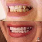 بهترین دندانپزشک زیبایی دکتر مهسا کوکبی در شیراز