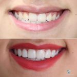 بهترین دندانپزشک زیبایی دکتر مهسا کوکبی در شیراز