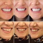 بهترین دندانپزشک زیبایی دکتر مهسا کوکبی در شیراز