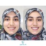 بهترین دندانپزشک زیبایی دکتر مهسا کوکبی در شیراز