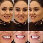 بهترین دندانپزشک زیبایی دکتر مهسا کوکبی در شیراز