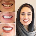 بهترین دندانپزشک زیبایی دکتر مهسا کوکبی در شیراز