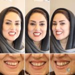 بهترین دندانپزشک زیبایی دکتر مهسا کوکبی در شیراز