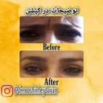 دکتر نوشین حیدریان در کرمانشاه