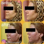 دکتر نوشین حیدریان در کرمانشاه