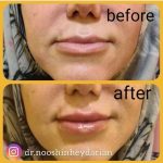 دکتر نوشین حیدریان در کرمانشاه