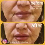 دکتر نوشین حیدریان در کرمانشاه