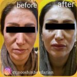 دکتر نوشین حیدریان در کرمانشاه