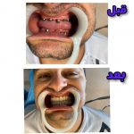 دکتر نبی اله هدایت پور در بابل