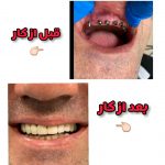 دکتر نبی اله هدایت پور در بابل