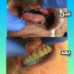 دکتر نبی اله هدایت پور در بابل