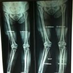 دکتر حسین لطفی در تربت حیدریه