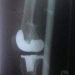 دکتر حسین لطفی در تربت حیدریه