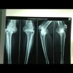 دکتر حسین لطفی در تربت حیدریه