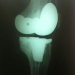 دکتر حسین لطفی در تربت حیدریه