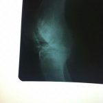 دکتر حسین لطفی در تربت حیدریه