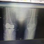 دکتر حسین لطفی در تربت حیدریه