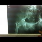 دکتر حسین لطفی در تربت حیدریه