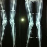 دکتر حسین لطفی در تربت حیدریه