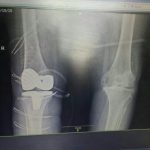 دکتر حسین لطفی در تربت حیدریه