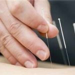 فیزیوتراپی فیزیوتراپ ابوالقاسم اخلاقی در تهران