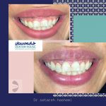 دکتر ستاره هاشمی در تهران