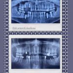 دکتر ستاره هاشمی در تهران