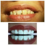 دکتر منصور عسگری در تهران