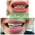 دکتر منصور عسگری در تهران