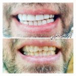 دکتر منصور عسگری در تهران