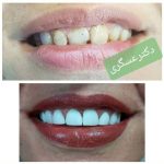 دکتر منصور عسگری در تهران