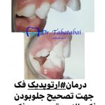 دکتر فتانه علوی طباطبایی در تهران