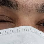 کلینیک پروتز چشم بیناسا در تهران