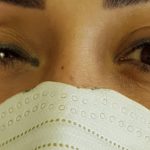 کلینیک پروتز چشم بیناسا در تهران