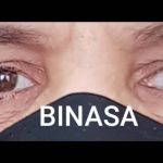 کلینیک پروتز چشم بیناسا در تهران