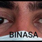 کلینیک پروتز چشم بیناسا در تهران