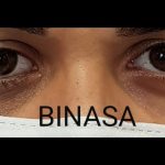 کلینیک پروتز چشم بیناسا در تهران