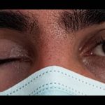 کلینیک پروتز چشم بیناسا در تهران