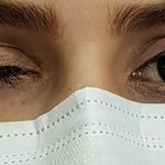 کلینیک پروتز چشم بیناسا در تهران