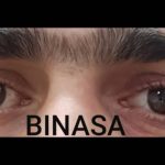 کلینیک پروتز چشم بیناسا در تهران