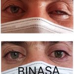 کلینیک پروتز چشم بیناسا در تهران