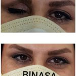 کلینیک پروتز چشم بیناسا در تهران